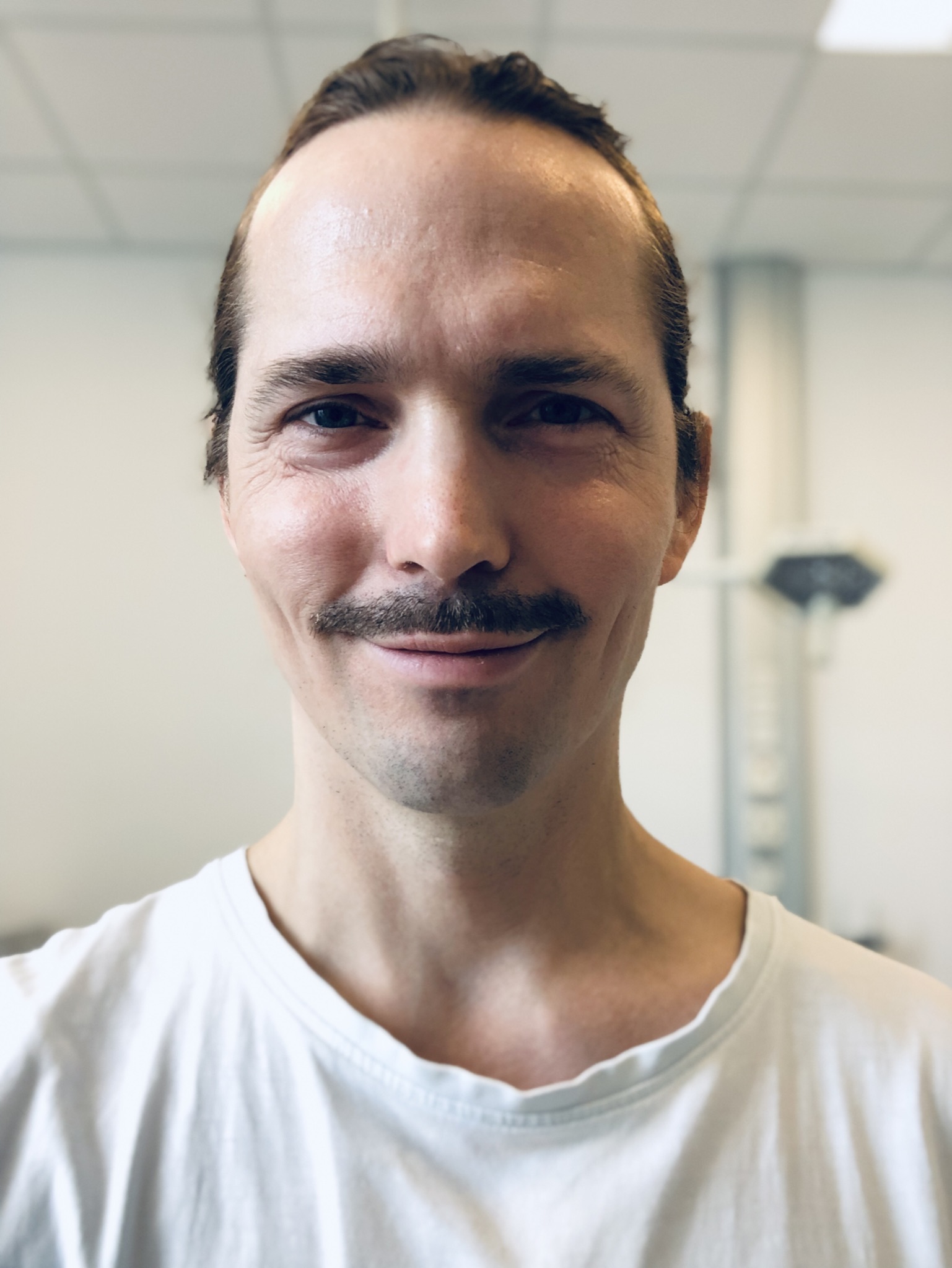 Hudlæge Thomas Kring | Alba Privathospital